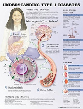 Full Download Understanding Type 1 Diabetes Anatomical Chart -  | ePub