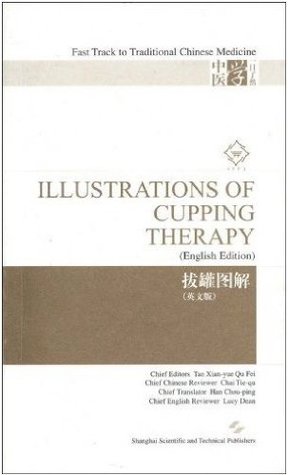 Full Download Illustrations of Cupping Therapy by Tao Xianyue,English,2009 - Tao Xianyue file in PDF