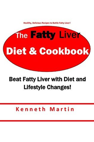 Read Online The Fatty Liver Diet & Cookbook: Beat Fatty Liver with Diet and Lifestyle Changes - Kenneth Martin file in ePub