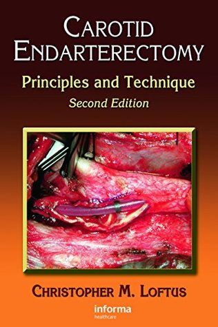 Read Carotid Endarterectomy: Principles and Technique - Christopher M. Loftus file in ePub