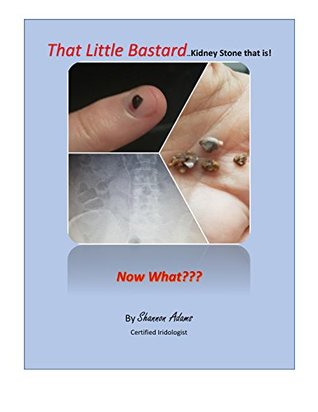 Read Online That Little BastardKidney Stone That Is!: Now What??? - Shannon Adams Kidneystoner file in PDF
